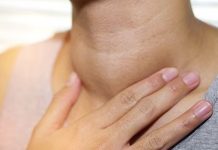 Tips mencegah kanker limfoma